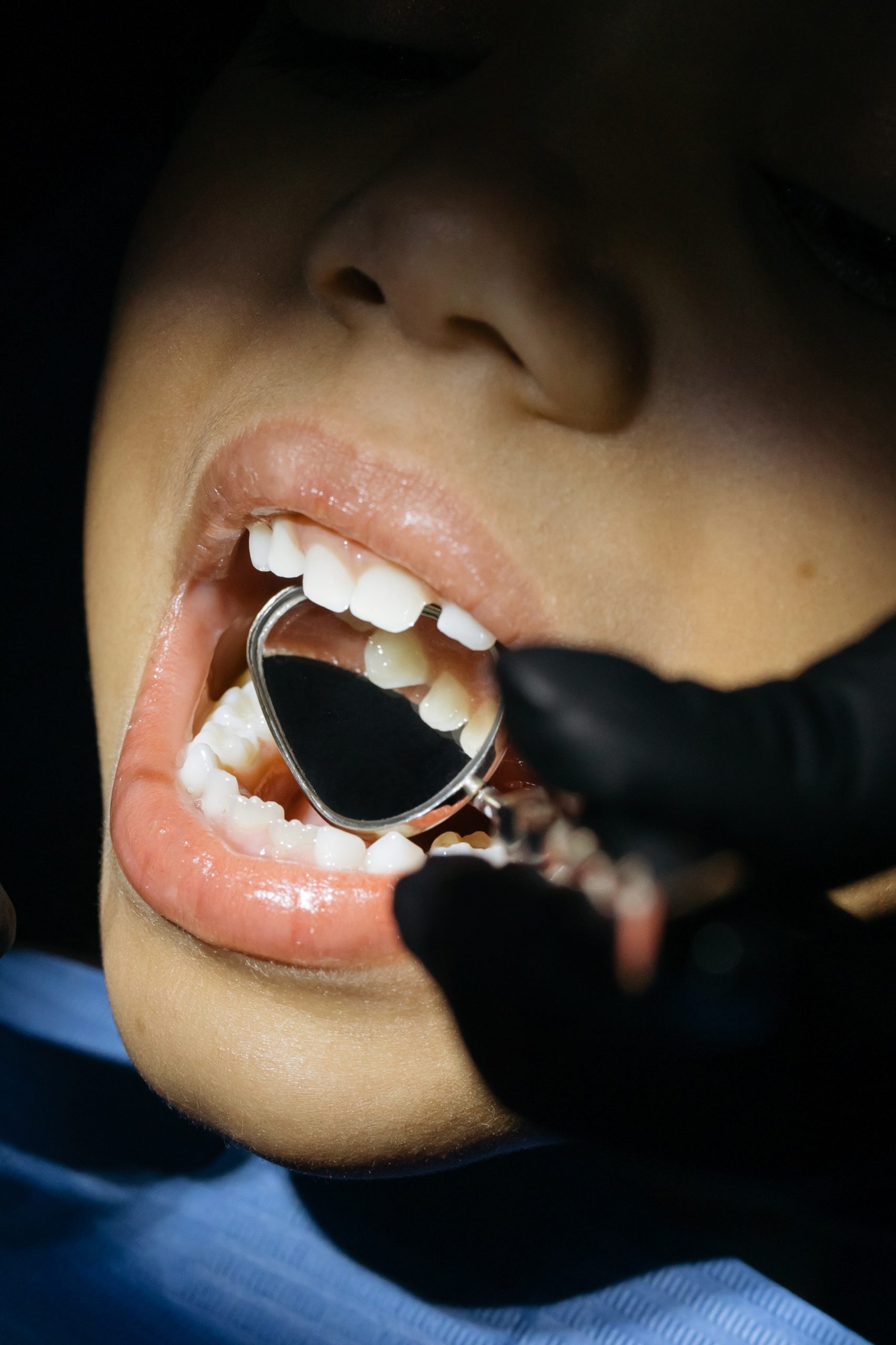 The Importance of Dental Cleaning